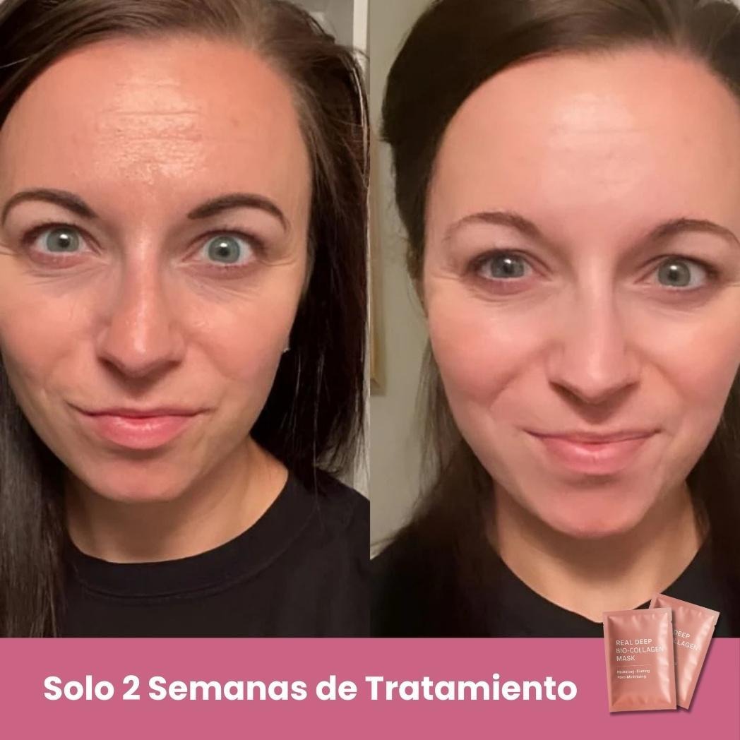 Regalo: 5 Mascarillas BIO Colágeno