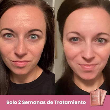 Regalo: 5 Mascarillas BIO Colágeno