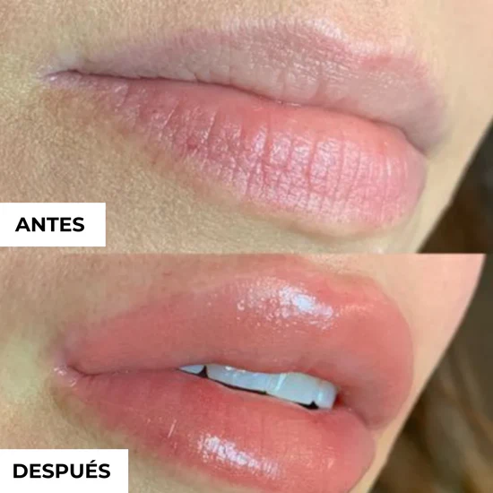 LipPlump - Voluminizador de Labios